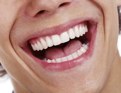 teeth laughing